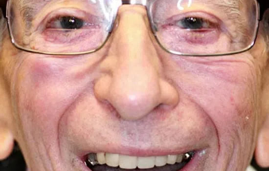 Elderly man smiling with glasses and close-up of dental implants and natural teeth in his mouth.