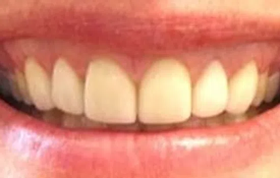 Close-up of a smiling mouth showing slightly spaced front teeth and pink lips.