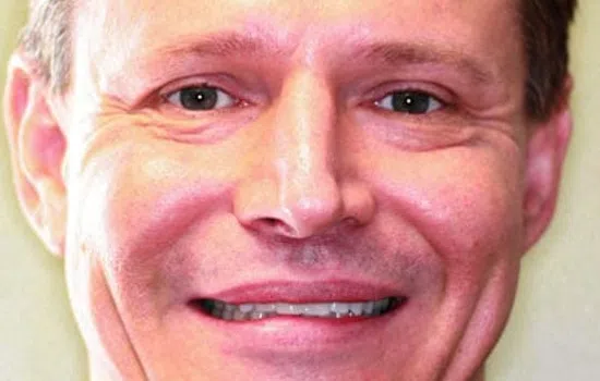 Close-up of a smiling man showing upper teeth with a focus on dental details in lower image section.