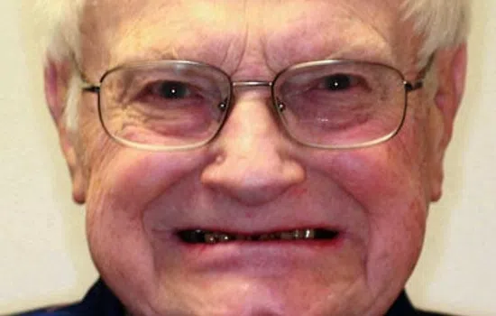 Elderly man with white hair and glasses showing a smile with severely decayed and missing teeth in close-up and full face.
