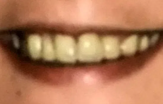 Close-up of a blurred smiling mouth showing upper teeth with lips slightly parted.
