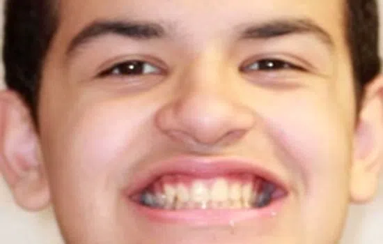 Close-up of a young man with curly hair smiling broadly showing his teeth against a plain background.