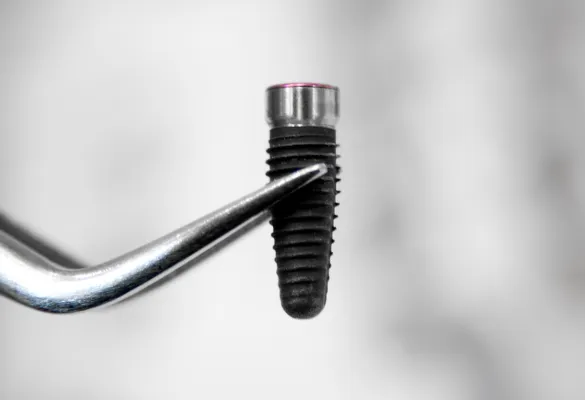 a close-up of a dental implant body