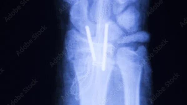 x-ray of a person's body
