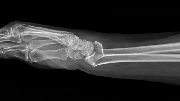 a close-up of a human bone