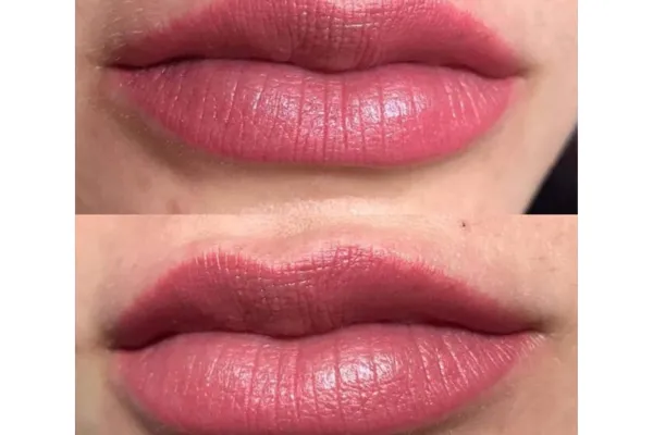 Lips