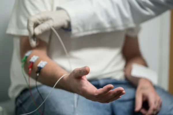 Neurodiagnostics Electromyography (EMG) Testing