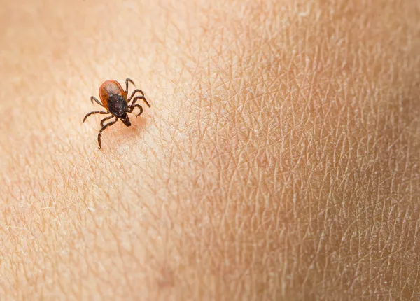 How to Remove a Tick