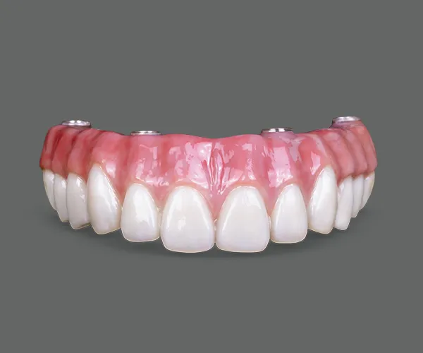 all on 4 hybrid denture