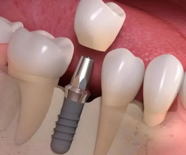 a group of white and black objects