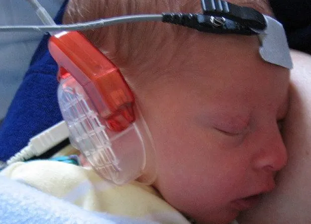 Newborn hearing screening is important for early intervention