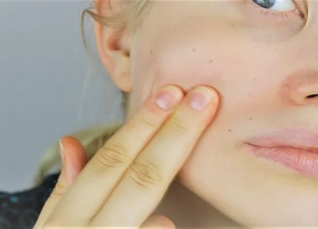 Benefits of microdermabrasion