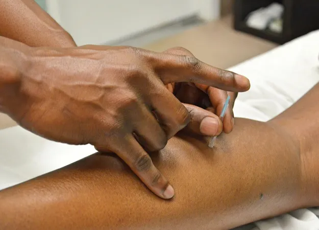 Acupuncture treatment: What are the health benefits?