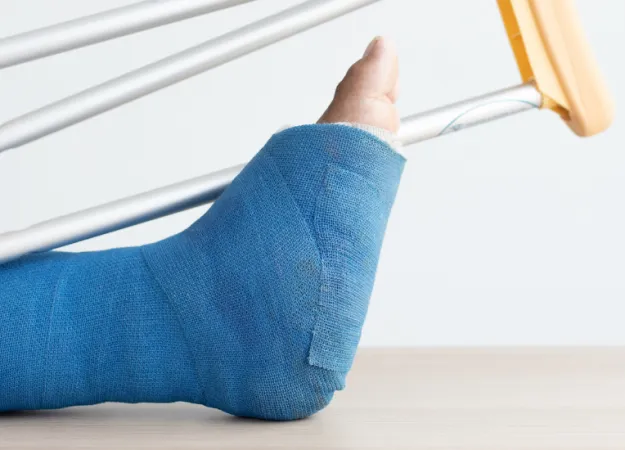 How does a plaster cast help heal an injury?