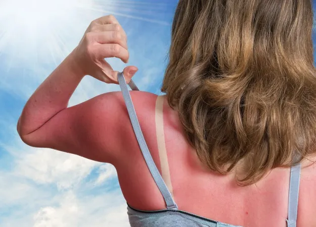 Skin cancer: Know your risks