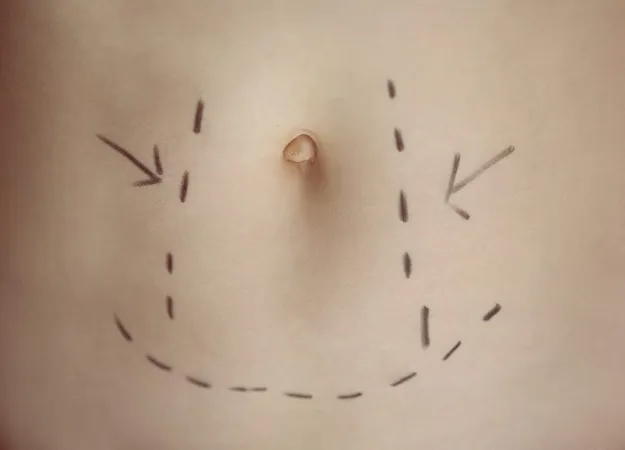 Postoperative care for breast augmentation and tummy tuck surgery