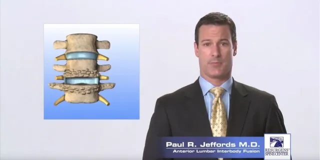 Anterior Lumbar Interbody Fusion