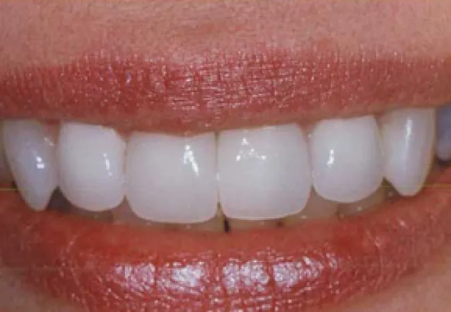 Close-up of a smiling mouth with clean, white teeth and natural lips.