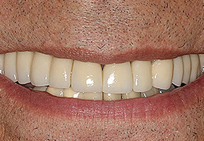 Close-up of a smile showing natural white teeth and lips against textured skin background.