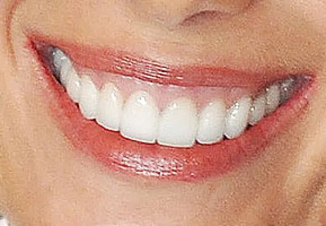 Close-up of a smiling mouth with white teeth and glossy lips.