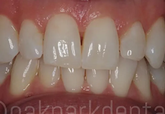 Close-up of healthy human teeth with natural alignment and pink gums in a smiling mouth.