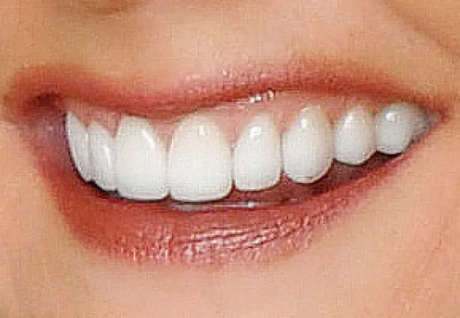 Close-up of a smiling mouth showing clean, white teeth and natural lips with a smooth texture.