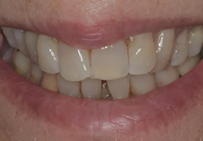 Close-up of a smiling mouth showing natural, slightly yellowed human teeth and pink lips.