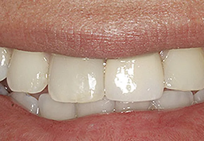Close-up of a smiling mouth showing clean, healthy white teeth and natural pink lips.