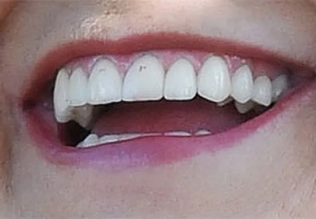 Close-up of smiling mouth showing healthy, white teeth and pink lips with natural skin texture.