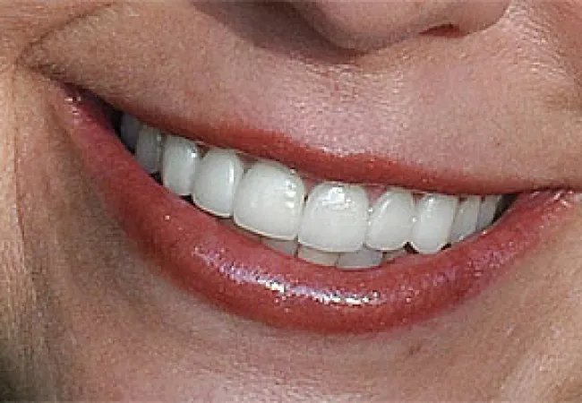 Close-up of a smiling mouth with white teeth and natural glossy lips showing fine skin texture.
