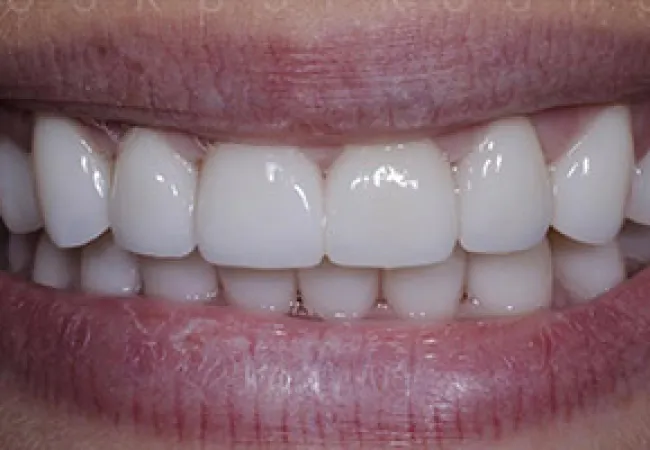 Close-up of a bright, healthy smile showing clean, white teeth and natural lips.