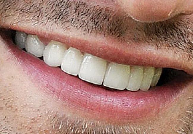 Close-up of a smiling man's mouth showing white teeth and light facial hair stubble on skin.