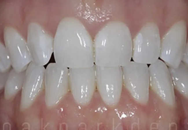 Close-up of healthy white teeth and gums with natural light reflection on enamel surface