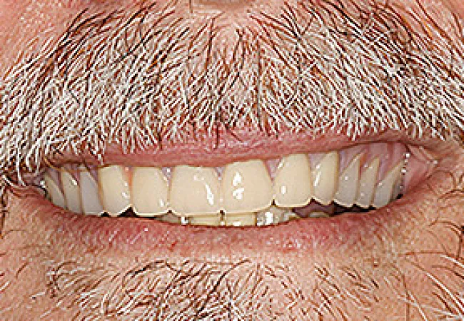Close-up of a smiling mouth with natural teeth and gray facial hair on upper lip and chin.