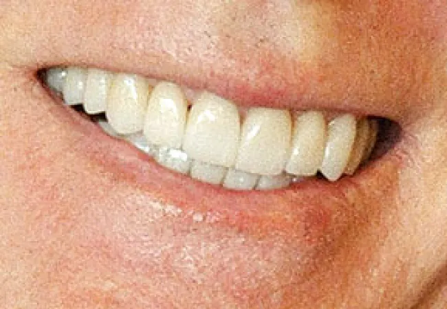Close-up of a smiling mouth showing clean, white teeth and healthy lips with natural skin texture.