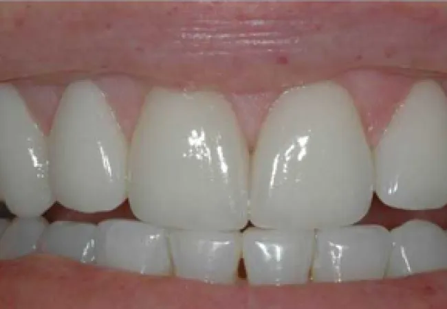 Close-up of a bright, healthy smile showing clean, aligned white teeth and gums.