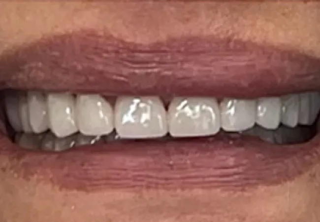 Close-up of a smiling mouth showing white, healthy teeth and natural lip texture.