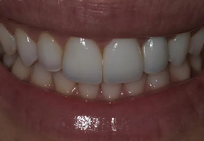 Close-up of a healthy smile showing white, well-aligned teeth and natural gums.