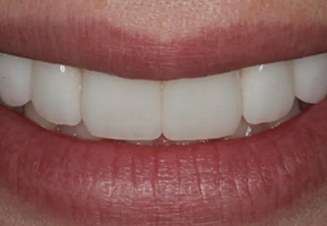 Close-up of a bright, clean smile with evenly aligned white teeth and natural pink lips