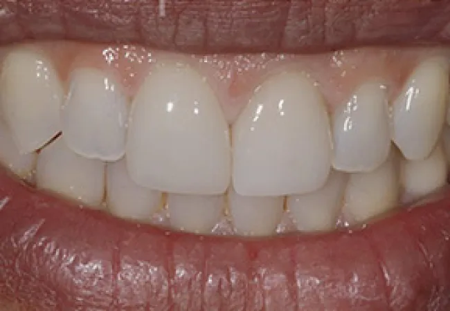 Close-up of a person's smile showing clean, white teeth and healthy lips with natural texture.