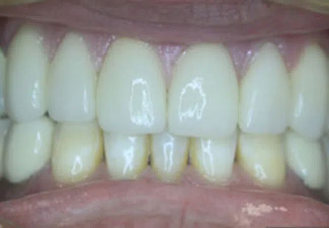 Smile Gallery - Close-up of a smiling woman showcasing bright, healthy teeth and smooth lips.