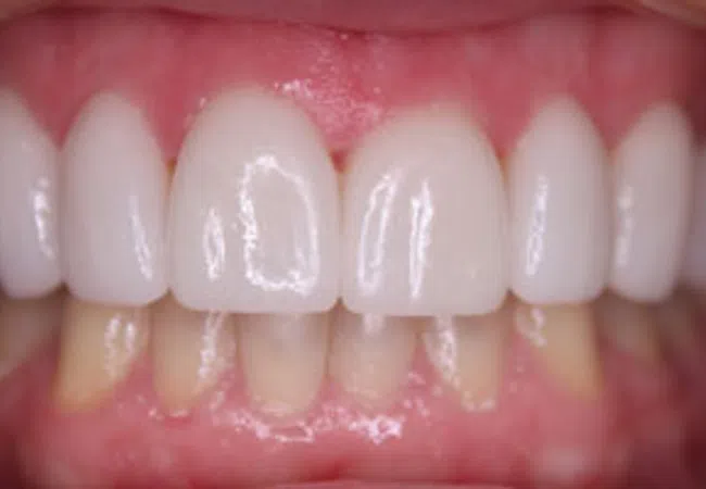 Smile Gallery - Close-up of a smiling woman showcasing bright, healthy teeth and smooth lips.