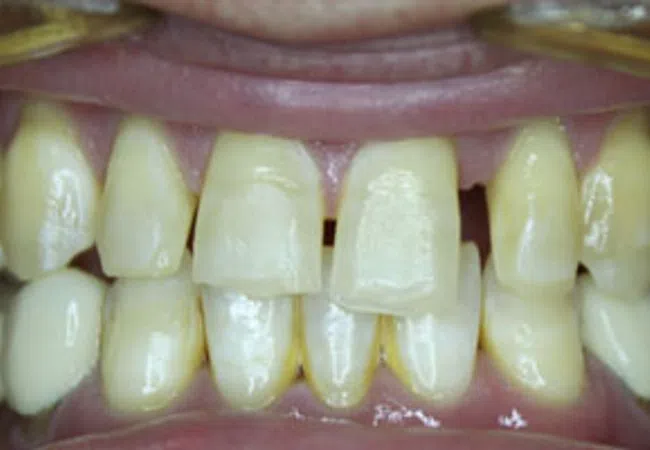 Smile Gallery - Close-up of a smiling woman showcasing bright, healthy teeth and smooth lips.
