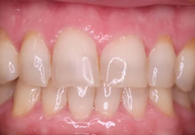 Smile Gallery - Close-up of a smiling woman showcasing bright, healthy teeth and smooth lips.