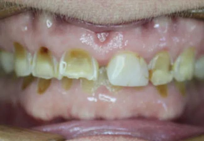 Smile Gallery - Close-up of a smiling woman showcasing bright, healthy teeth and smooth lips.