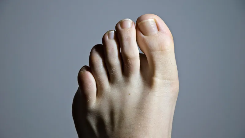 a foot with a toenail