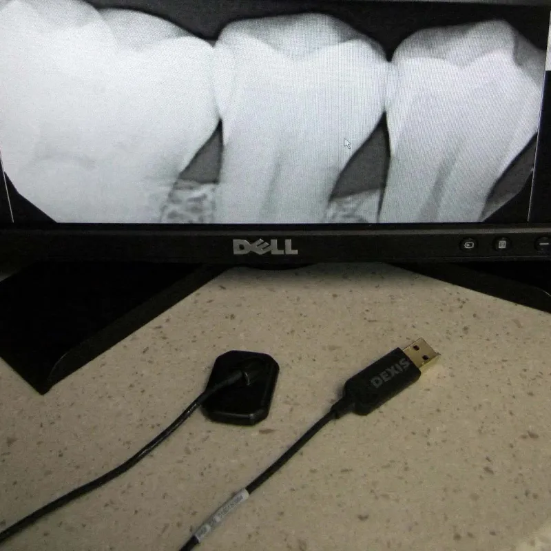 Dental X-ray image displayed on Dell monitor with dental sensor and USB device on countertop