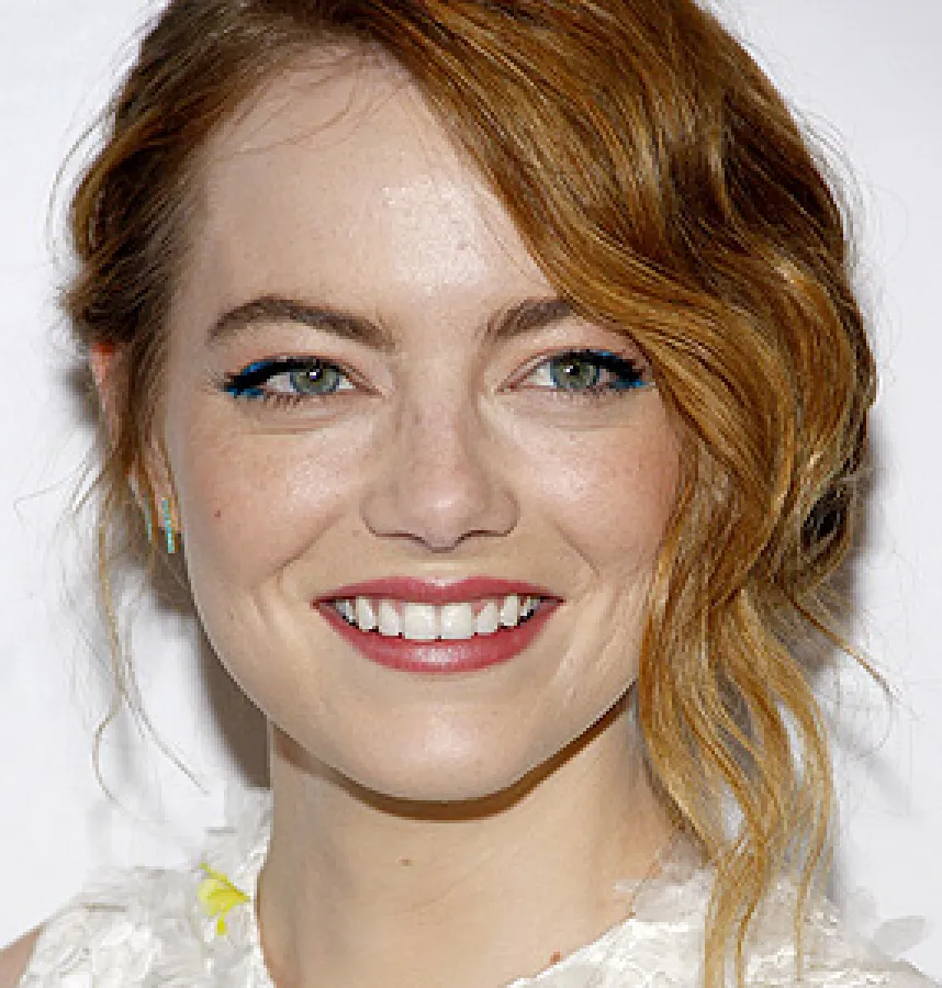 Actress Emma Stone Reveals How Thumb Sucking Affected Her Teeth