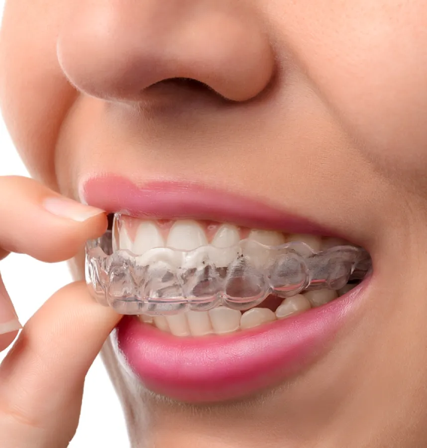 What Invisalign Can Do for You