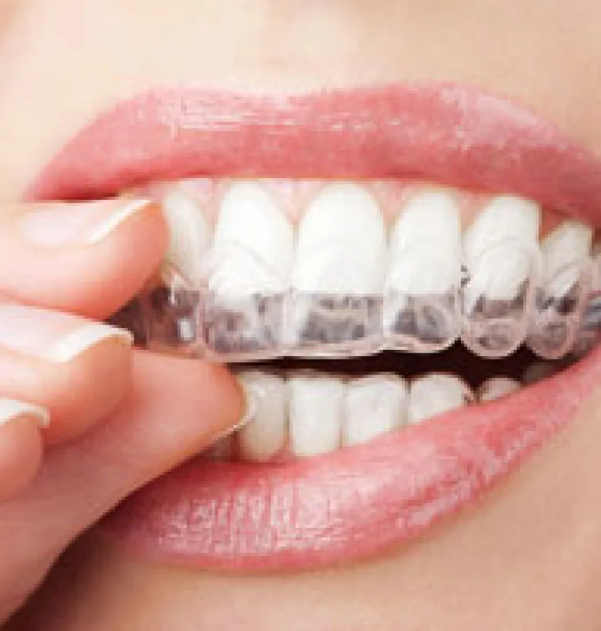 Invisalign Is The Clear Way To Straighten Teeth